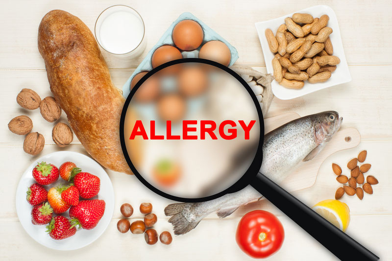 Humble, Texas 77338 food allergies and sensitivity treatment